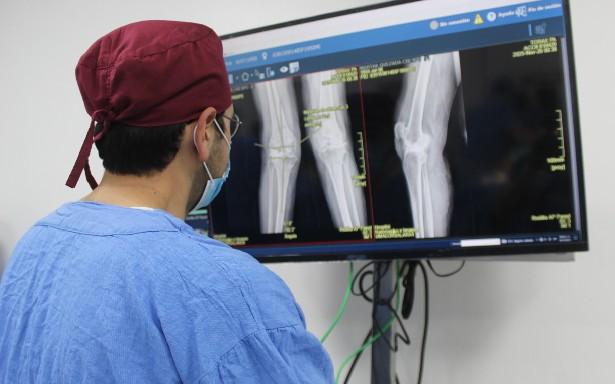 El IMSS incorpora cirugía robótica para reemplazo de rodilla que reduce sangrado, dolor y tiempo de recuperación en pacientes